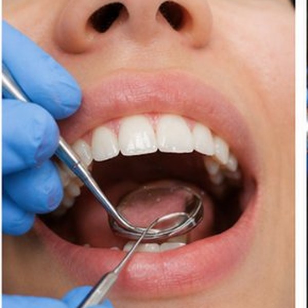 Valoración Dental